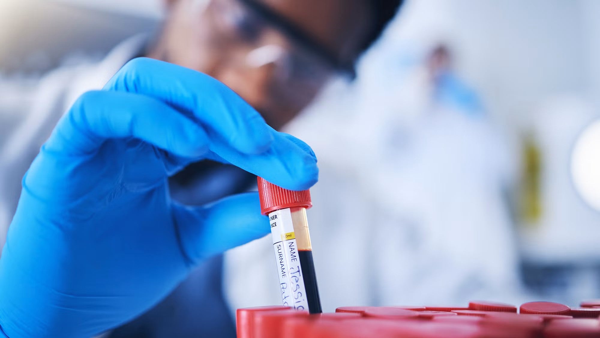 A researcher wearing a white coat and blue gloves places test tubes of blood into a holder