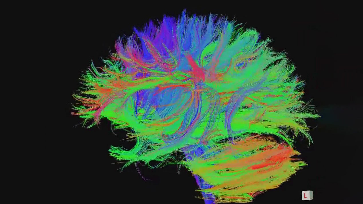 A brain illustrated with colorful sections