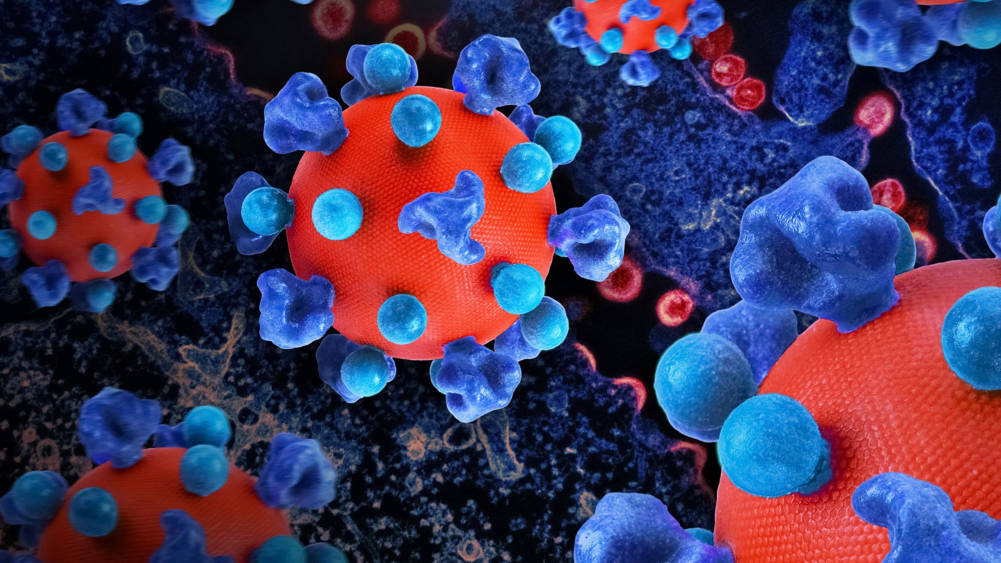 HIV Virus Creative artwork featuring colorized 3D prints of HIV virus particles